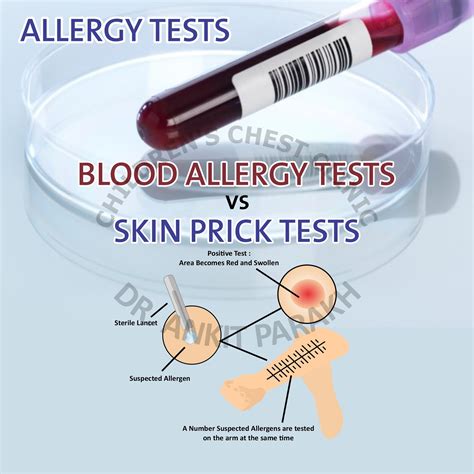 blood drop finger prick allergy testing|allergy blood test false positive.